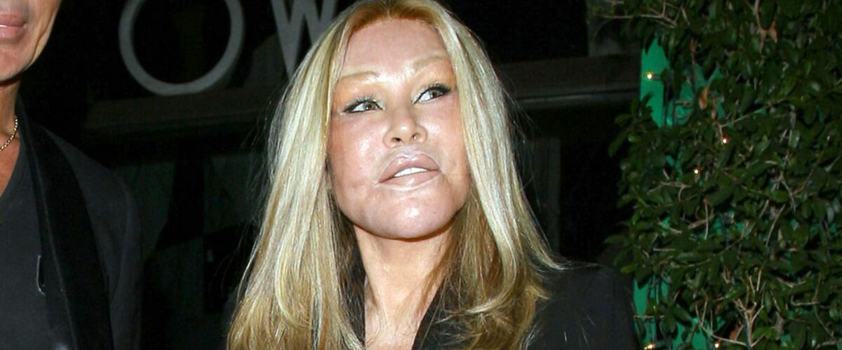 Video Jocelyn Wildenstein Revivez La Folle Transformation Physique De La Femme Chat Gala