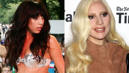 lady gaga age lady gaga avant chirurgie esthetique