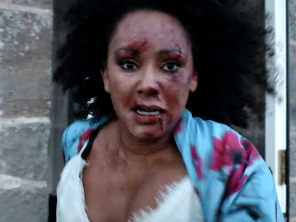 Spice Girls : Mel B complètement défigurée dans une vidéo choquante