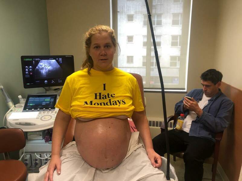 La comédienne Amy Schumer partage avec humour l'expérience de sa première grossesse sur les réseaux sociaux