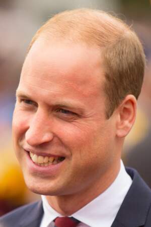 2016 : le prince William a 34 ans assume sa calvitie 