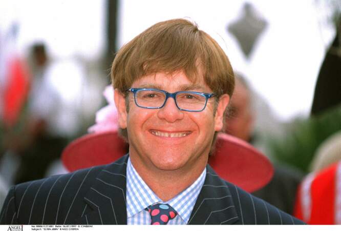 Elton John et sa chevelure rehaussée par des implants capillaires
